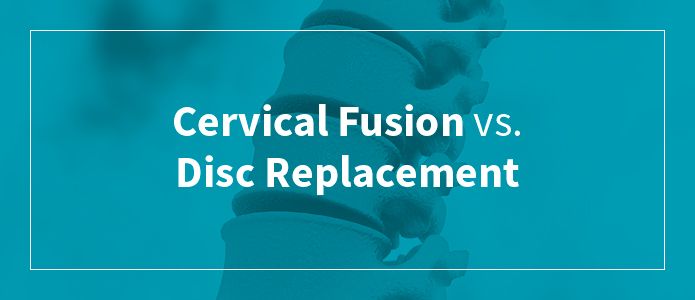 cervical disc replacement procedure